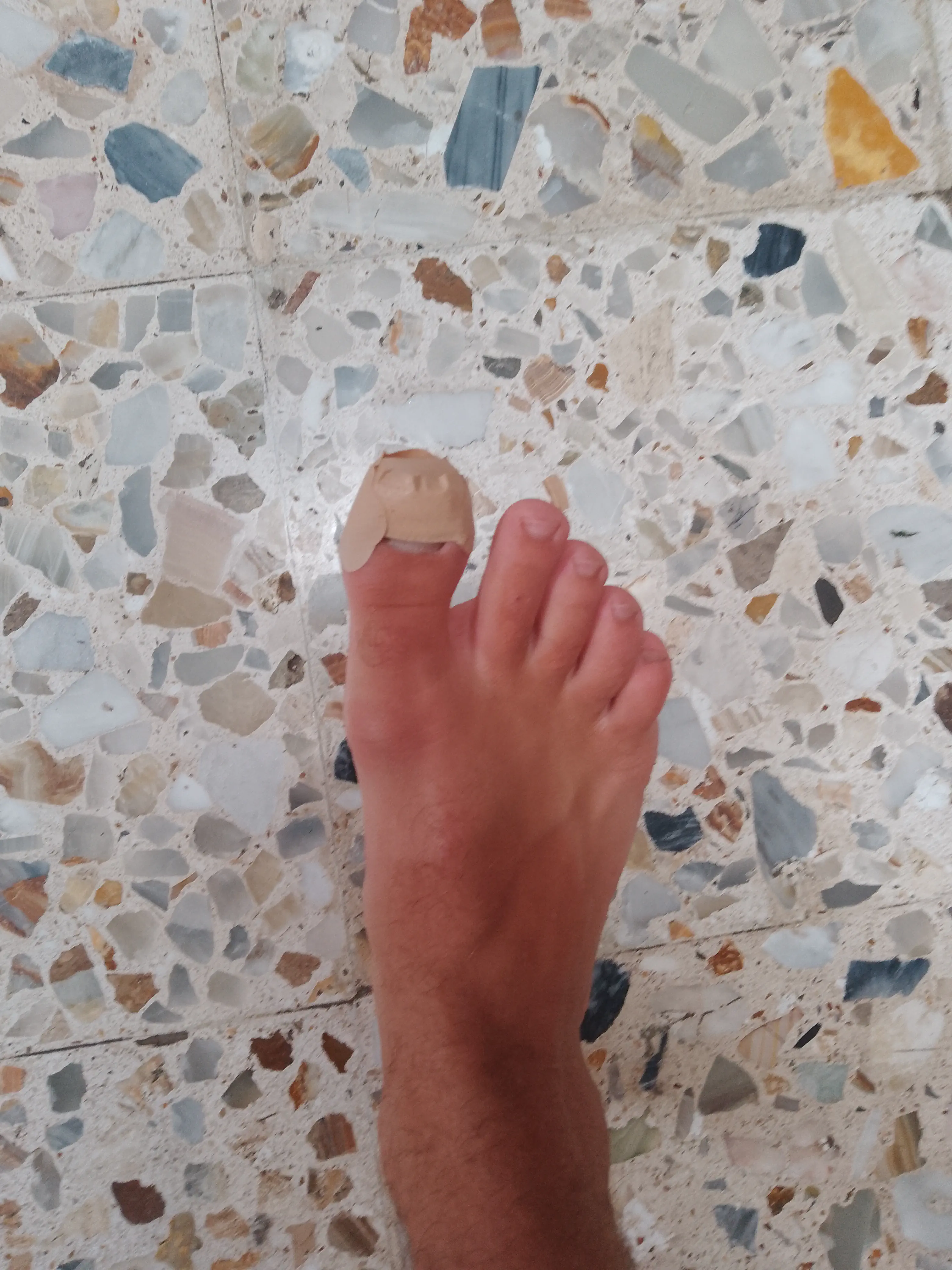 Foot with big toe wrapped in a plaster
