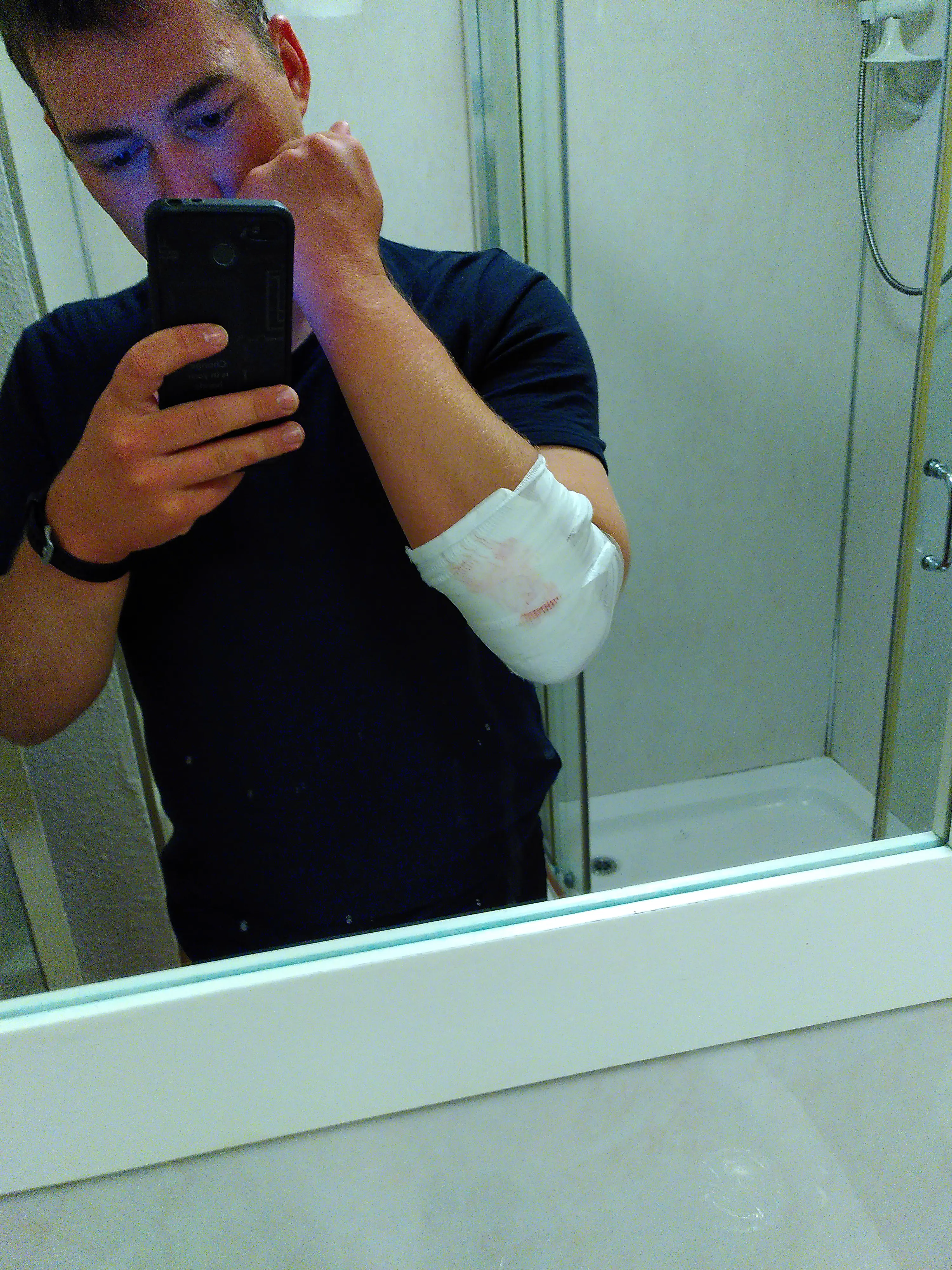 Me in the mirror, with a bloody bandage on my elbow