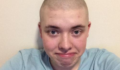Man with shaved head
