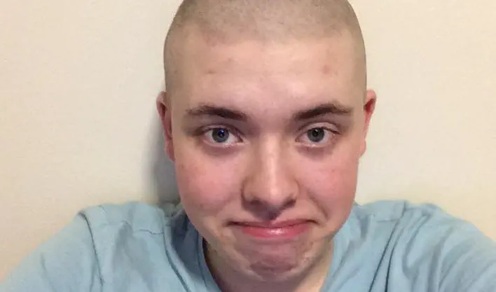 Man with shaved head